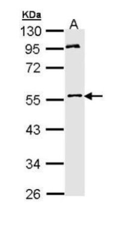 Invitrogen MPP1 Polyclonal Antibody 100 &mu;L | Buy Online | Invitrogen&trade; | Fisher Scientific