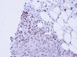Invitrogen SSRP1 Polyclonal Antibody 100 &mu;L; Unconjugated:Antibodies,