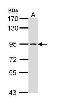 Invitrogen SSRP1 Polyclonal Antibody 100 &mu;L; Unconjugated:Antibodies,