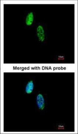 Invitrogen CKS2 Polyclonal Antibody 100 &mu;L | Buy Online | Invitrogen&trade; | Fisher Scientific
