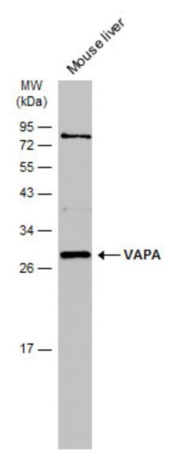 Invitrogen VAPA Polyclonal Antibody 100 &mu;L | Buy Online | Invitrogen&trade; | Fisher Scientific