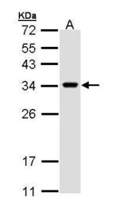 Invitrogen VAPA Polyclonal Antibody 100 &mu;L | Buy Online | Invitrogen&trade; | Fisher Scientific