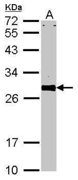 Invitrogen VAPA Polyclonal Antibody 100 &mu;L | Buy Online | Invitrogen&trade; | Fisher Scientific