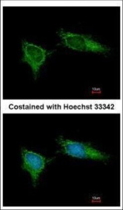 Invitrogen NDUFB5 Polyclonal Antibody 100 &mu;L; Unconjugated:Antibodies,