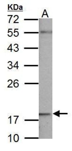 Invitrogen NDUFB5 Polyclonal Antibody 100 &mu;L; Unconjugated:Antibodies,