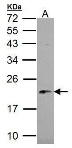 Invitrogen NDUFB5 Polyclonal Antibody 100 &mu;L; Unconjugated:Antibodies,