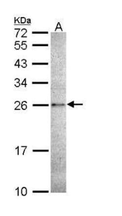 Invitrogen Caspase 14 Polyclonal Antibody 100 &mu;L | Buy Online | Invitrogen&trade; | Fisher Scientific