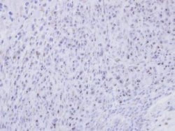 Invitrogen SMC1B Polyclonal Antibody 100 &mu;L; Unconjugated:Antibodies,