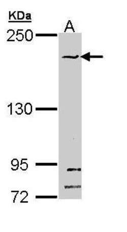 Invitrogen SMC1B Polyclonal Antibody 100 &mu;L; Unconjugated:Antibodies,