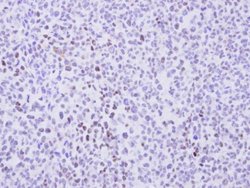 Invitrogen Cyclin T2 Polyclonal Antibody 100 &mu;L; Unconjugated:Antibodies,