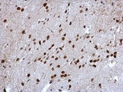 Invitrogen Cyclin T2 Polyclonal Antibody 100 &mu;L; Unconjugated:Antibodies,