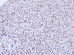 Invitrogen PCNP Polyclonal Antibody 100 &mu;L | Buy Online | Invitrogen&trade; | Fisher Scientific