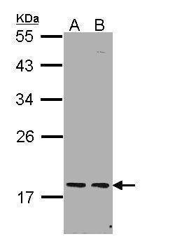 Invitrogen PCNP Polyclonal Antibody 100 &mu;L | Buy Online | Invitrogen&trade; | Fisher Scientific