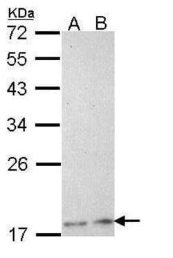 Invitrogen PLA2G12A Polyclonal Antibody 100 &mu;L; Unconjugated:Antibodies,
