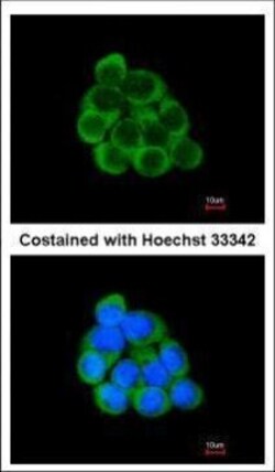 Invitrogen PECR Polyclonal Antibody 100 &mu;L; Unconjugated:Antibodies,