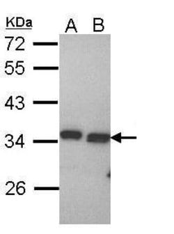 Invitrogen PECR Polyclonal Antibody 100 &mu;L; Unconjugated:Antibodies,
