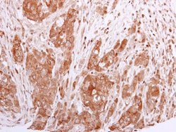 Invitrogen BCL2L12 Polyclonal Antibody 100 &mu;L; Unconjugated:Antibodies,
