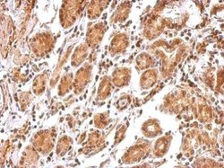 Invitrogen BCL2L12 Polyclonal Antibody 100 &mu;L; Unconjugated:Antibodies,