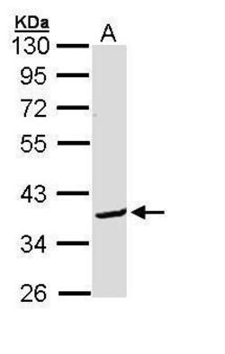 Invitrogen BCL2L12 Polyclonal Antibody 100 &mu;L; Unconjugated:Antibodies,