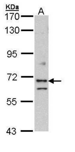 Invitrogen EXOC7 Polyclonal Antibody 100 &mu;L; Unconjugated:Antibodies,