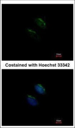 Invitrogen MGAT3 Polyclonal Antibody 100 μL; Unconjugated:Antibodies,