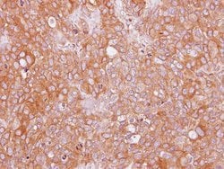 Invitrogen AdoHcyase 3 Polyclonal Antibody 100 &mu;L; Unconjugated:Antibodies,