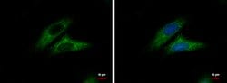 Invitrogen CTNNAL1 Polyclonal Antibody 100 μL; Unconjugated:Antibodies,