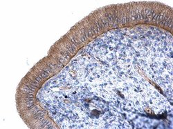 Invitrogen CTNNAL1 Polyclonal Antibody 100 μL; Unconjugated:Antibodies,