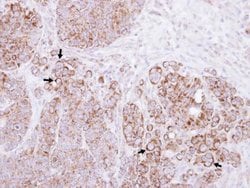 Invitrogen CTNNAL1 Polyclonal Antibody 100 μL; Unconjugated:Antibodies,