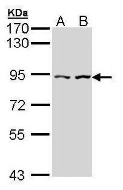 Invitrogen CTNNAL1 Polyclonal Antibody 100 μL; Unconjugated:Antibodies,