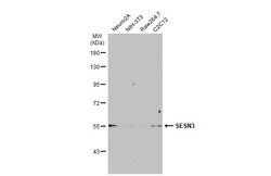 Invitrogen SESN3 Polyclonal Antibody 100 &mu;L | Buy Online | Invitrogen&trade; | Fisher Scientific