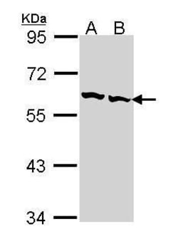 Invitrogen TCP-1 beta Polyclonal Antibody 100 &mu;L; Unconjugated:Antibodies,