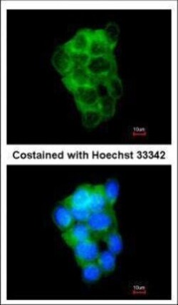 Invitrogen PPFIBP2 Polyclonal Antibody 100 &mu;L; Unconjugated:Antibodies,
