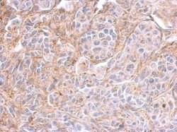 Invitrogen PPFIBP2 Polyclonal Antibody 100 &mu;L; Unconjugated:Antibodies,