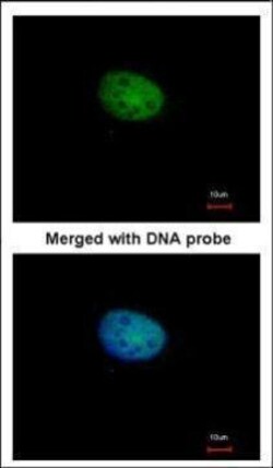 Invitrogen RBPJ Polyclonal Antibody 100 &mu;L; Unconjugated:Antibodies,