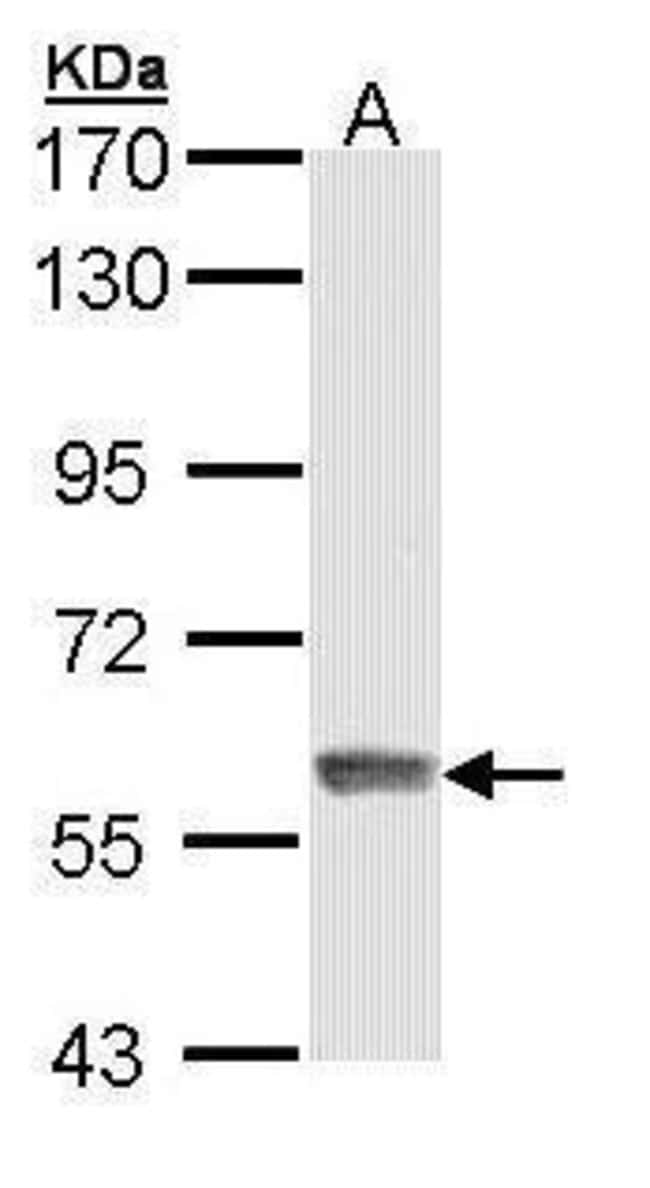 Invitrogen IFIT3 Polyclonal Antibody 100 μL; Unconjugated