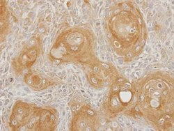 Invitrogen INPP5B Polyclonal Antibody 100 &mu;L; Unconjugated:Antibodies,