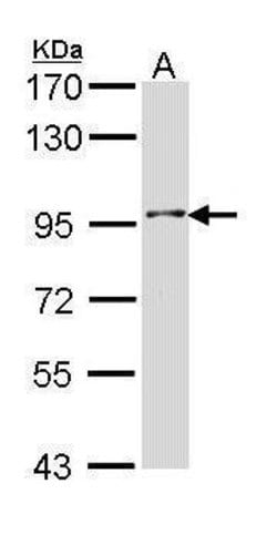 Invitrogen INPP5B Polyclonal Antibody 100 &mu;L; Unconjugated:Antibodies,