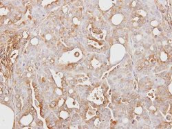 Invitrogen ITIH3 Polyclonal Antibody 100 &mu;L; Unconjugated:Antibodies,