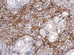 Invitrogen ITIH3 Polyclonal Antibody 100 &mu;L; Unconjugated:Antibodies,