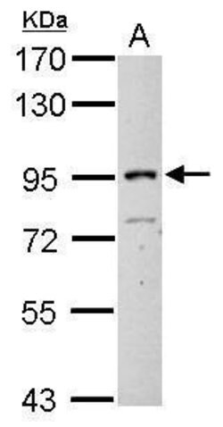 Invitrogen ITIH3 Polyclonal Antibody 100 &mu;L; Unconjugated:Antibodies,