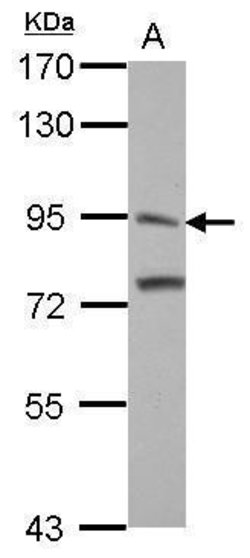 Invitrogen ITIH3 Polyclonal Antibody 100 &mu;L; Unconjugated:Antibodies,