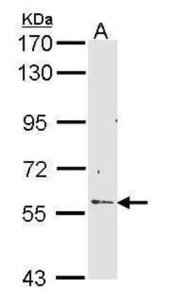 Invitrogen RCBTB2 Polyclonal Antibody 100 &mu;L; Unconjugated:Antibodies,