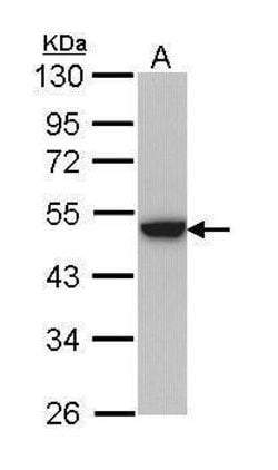 Invitrogen Cytokeratin 31 Polyclonal Antibody 100 &mu;L; Unconjugated:Antibodies,