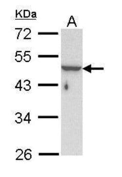 Invitrogen Cytokeratin 33B Polyclonal Antibody 100 μL; Unconjugated:Antibodies,