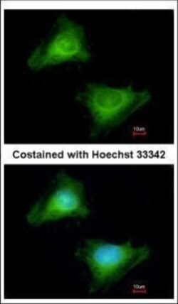 Invitrogen GBP3 Polyclonal Antibody 100 &mu;L; Unconjugated:Antibodies,