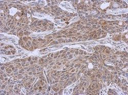 Invitrogen DLST Polyclonal Antibody 100 &mu;L | Buy Online | Invitrogen&trade; | Fisher Scientific