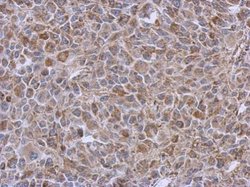 Invitrogen DLST Polyclonal Antibody 100 &mu;L | Buy Online | Invitrogen&trade; | Fisher Scientific