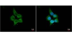 Invitrogen HHIP Polyclonal Antibody 100 &mu;L; Unconjugated:Antibodies,