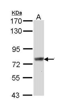 Invitrogen SCIN Polyclonal Antibody 100 &mu;L; Unconjugated:Antibodies,